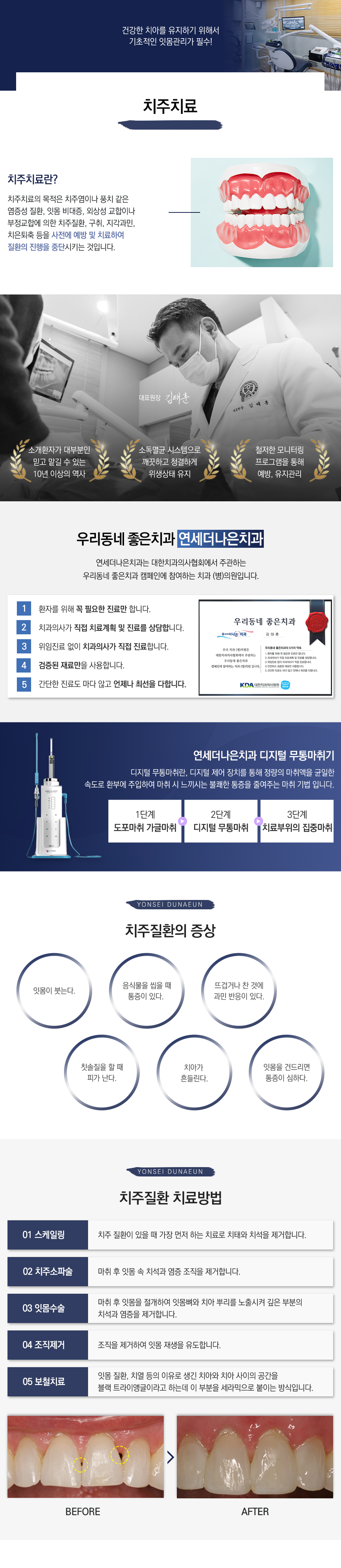 치주치료