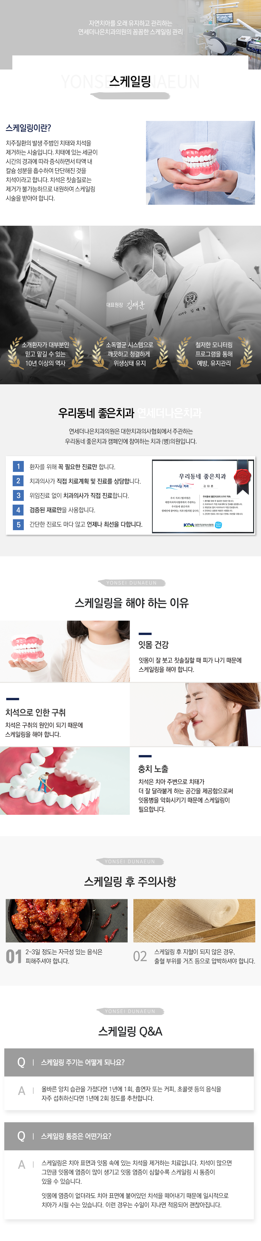 스케일링